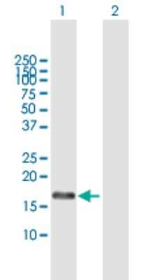 Western Blot: RFK Antibody [H00055312-B01P]