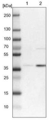Western Blot: RFNG Antibody [NBP1-90946]