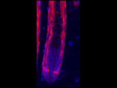 Immunocytochemistry/ Immunofluorescence: RFP Antibody [NBP1-69962]