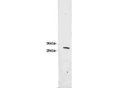 Western Blot: RFP Antibody [NBP1-97371]