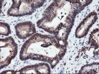Immunohistochemistry-Paraffin: RFPL3 Antibody (OTI2G4) [NBP2-02034]