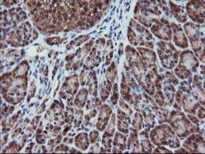 Immunohistochemistry-Paraffin: RFPL3 Antibody (OTI2G4) [NBP2-02034]