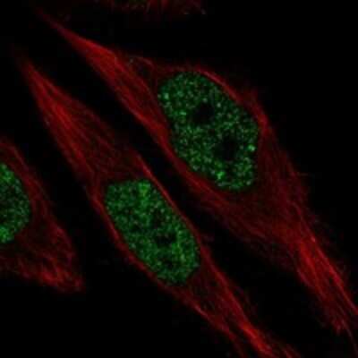 Immunocytochemistry/ Immunofluorescence: RFX1 Antibody [NBP3-17759]