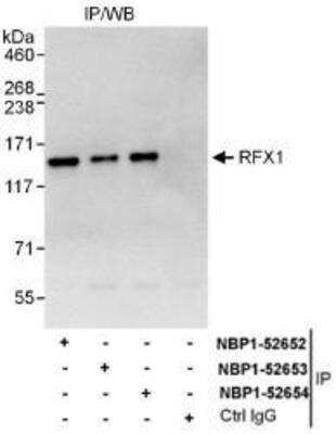 Western Blot: RFX1 Antibody [NBP1-52653]
