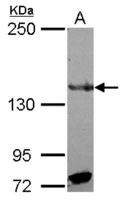 Western Blot: RFX1 Antibody [NBP2-20142]