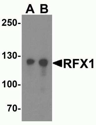 Western Blot: RFX1 AntibodyBSA Free [NBP2-82031]