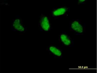 Immunocytochemistry/ Immunofluorescence: RFX3 Antibody [H00005991-B01P]