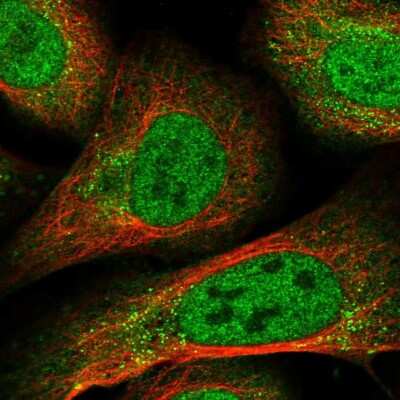 Immunocytochemistry/ Immunofluorescence: RFX3 Antibody [NBP1-86301]