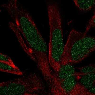 Immunocytochemistry/ Immunofluorescence: RFX4 Antibody [NBP2-48967]