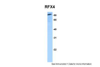 Western Blot: RFX4 Antibody [NBP2-88147]
