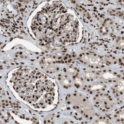 Immunohistochemistry-Paraffin: RFX5 Antibody [NBP1-86041]