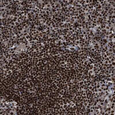 Immunohistochemistry-Paraffin: RFX5 Antibody [NBP1-86041]