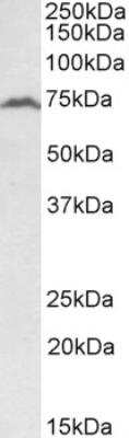 Western Blot: RFX5 Antibody [NBP2-26106]
