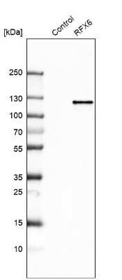 Western Blot: RFX6 Antibody [NBP2-48677]