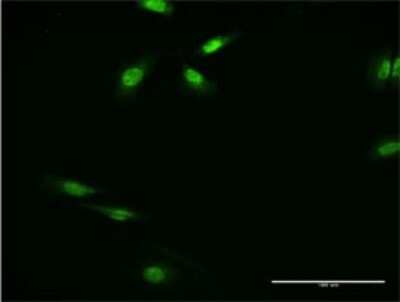 Immunocytochemistry/ Immunofluorescence: RFXANK Antibody (4G10) [H00008625-M01]