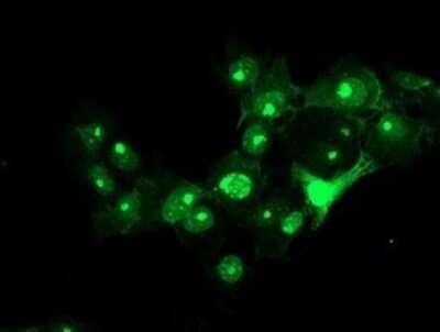 Immunofluorescence: RFXANK Antibody (OTI3B4) [NBP2-45571]