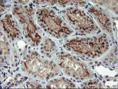 Immunohistochemistry: RFXANK Antibody (OTI3E7) - Azide and BSA Free [NBP2-73870]
