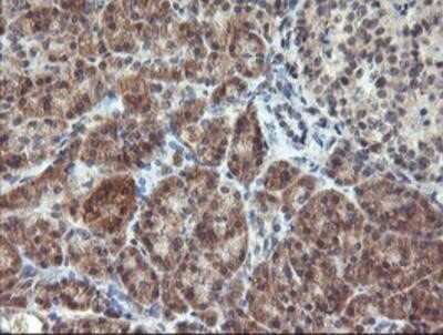 Immunohistochemistry-Paraffin: RFXANK Antibody (OTI3E7) [NBP2-01756]
