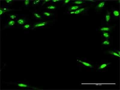 Immunocytochemistry/ Immunofluorescence: RFXAP Antibody [H00005994-D01P]