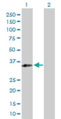 Western Blot: RFXAP Antibody [H00005994-D01P]