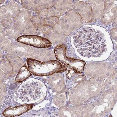 Immunohistochemistry-Paraffin: RG9MTD2 Antibody [NBP2-13226]