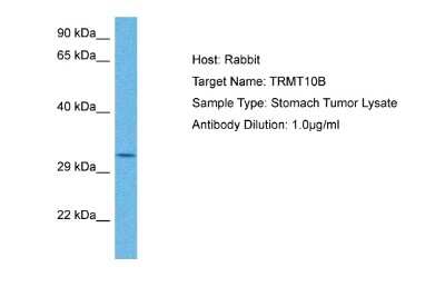 Western Blot: RG9MTD3 Antibody [NBP2-85632]