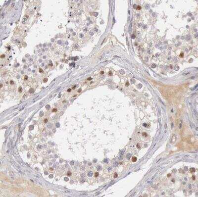 Immunohistochemistry-Paraffin: RGAG1 Antibody [NBP1-82914]