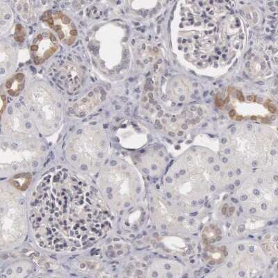 Immunohistochemistry-Paraffin: RGAG1 Antibody [NBP1-82914]