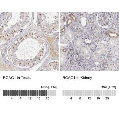 Immunohistochemistry-Paraffin: RGAG1 Antibody [NBP1-82914]