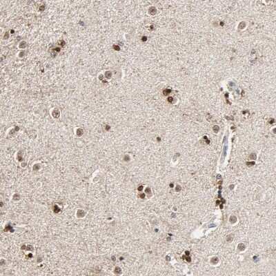 Immunohistochemistry-Paraffin: RGAG4 Antibody [NBP1-93561]