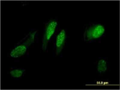 Immunocytochemistry/ Immunofluorescence: RGC32 Antibody (3B9) [H00028984-M01]