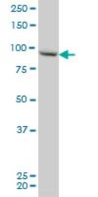 Western Blot: RGL2 Antibody (4D10) [H00005863-M02]