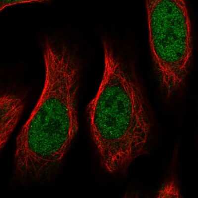 Immunocytochemistry/ Immunofluorescence: RGM-A Antibody [NBP2-58165]