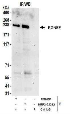 Immunoprecipitation: RGNEF Antibody [NBP2-22282]