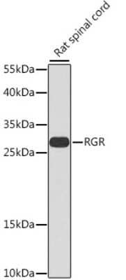 Western Blot: RGR AntibodyBSA Free [NBP2-93641]
