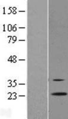 Western Blot: RGR Overexpression Lysate [NBL1-15318]