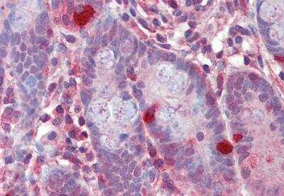 Immunohistochemistry-Paraffin: RGS1 Antibody [NB100-1029]