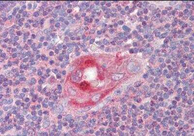 Immunohistochemistry-Paraffin: RGS1 Antibody [NB100-1029]