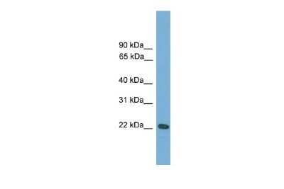 Western Blot: RGS1 Antibody [NBP2-82336]