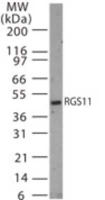 Western Blot: RGS11 Antibody [NB100-56658]