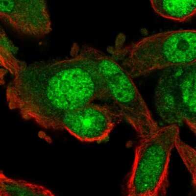 Immunocytochemistry/ Immunofluorescence: RGS12 Antibody [NBP2-56165]