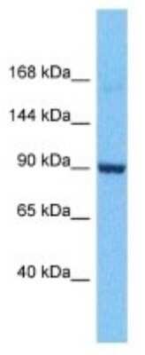 Western Blot: RGS12 Antibody [NBP3-09983]