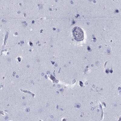 Immunohistochemistry-Paraffin: RGS13 Antibody [NBP3-17112]