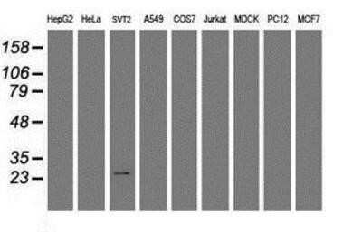 Western Blot: RGS16 Antibody (OTI4E5)Azide and BSA Free [NBP2-73881]