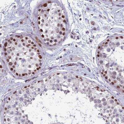 Immunohistochemistry-Paraffin: RGS17 Antibody [NBP1-80839]