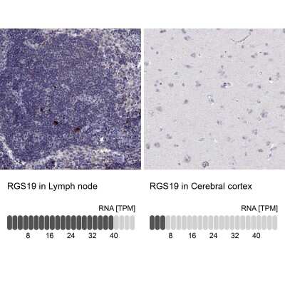 Immunohistochemistry-Paraffin: RGS19 Antibody [NBP2-62666]