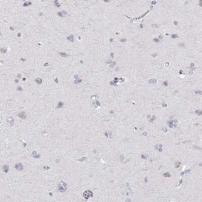 Immunohistochemistry-Paraffin: RGS19 Antibody [NBP2-62666]