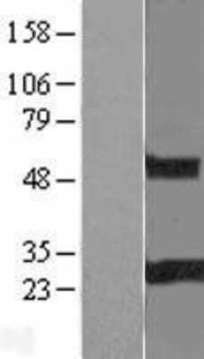 Western Blot: RGS19 Overexpression Lysate [NBL1-15326]