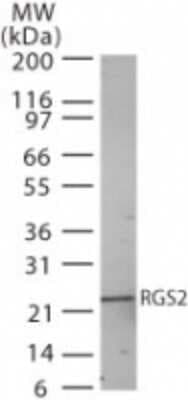 Western Blot: RGS2 Antibody [NB100-56736]