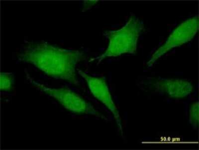Immunocytochemistry/ Immunofluorescence: RGS20 Antibody (3E10) [H00008601-M04]
